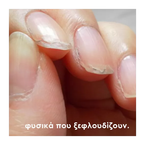 φυσικά νύχια που ξεφλουδίζουν