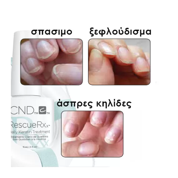 προβλήματα φυσικών νυχιών θεραπεία cnd rescuerxx